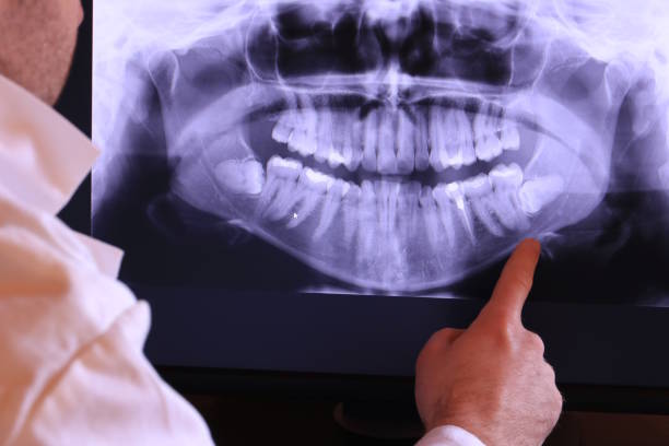 Best Emergency Treatment for Dental Infections or Abscesses in Randleman, NC