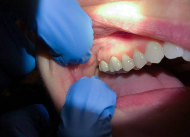 Best Emergency TMJ Treatment in Randleman, NC